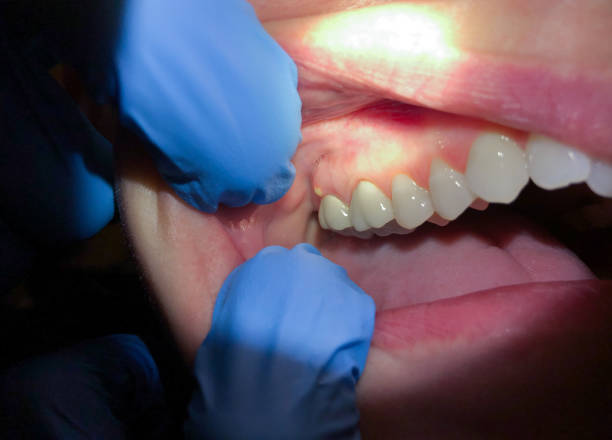  Poplar Cotton Center, CA Emergency Dentist Pros