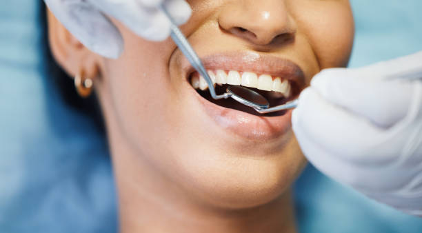 Best Emergency Gum Treatment in Poplar Cotton Center, CA